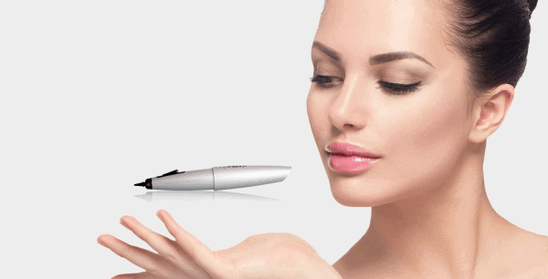 CryoPen Cryotherapy Ilkeston