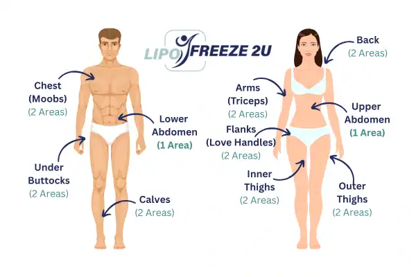 Areas you can have fat freezing treatment Ilkeston