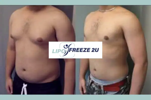 How Long Does It Take to See Results Ilkeston?