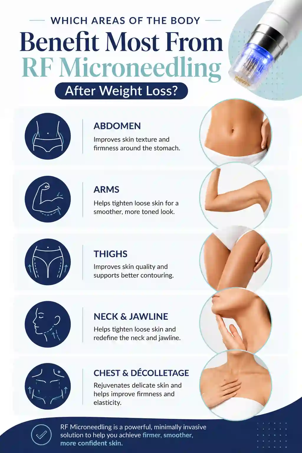 Which Areas of the Body Benefit Most From RF Microneedling After Weight Loss Ilkeston