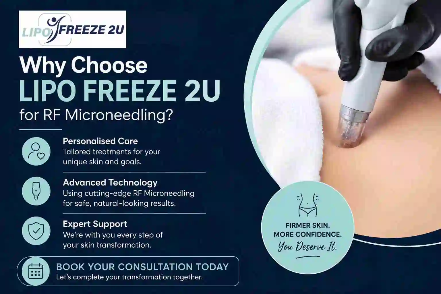 Why Choose LIPO FREEZE 2U for RF Microneedling Ilkeston?